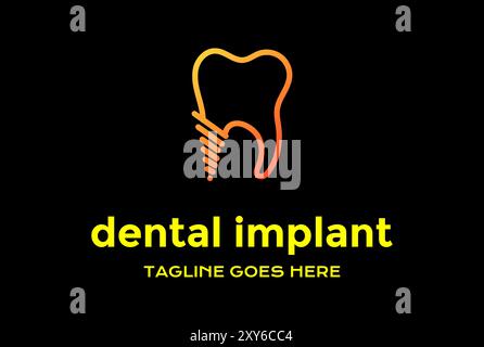 Einfache Minimalistische Moderne Dental Implant Line Outline Logo Design Vektor Stock Vektor