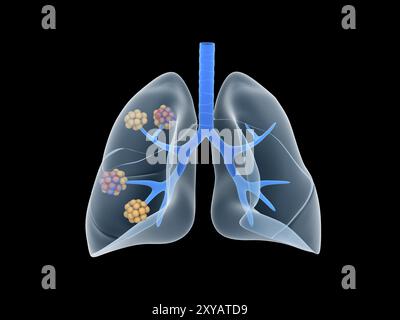 Das konzeptionelle Bild der menschlichen Lunge Stockfoto