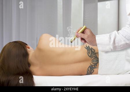 Moxa-Therapie für eine junge Frau Stockfoto