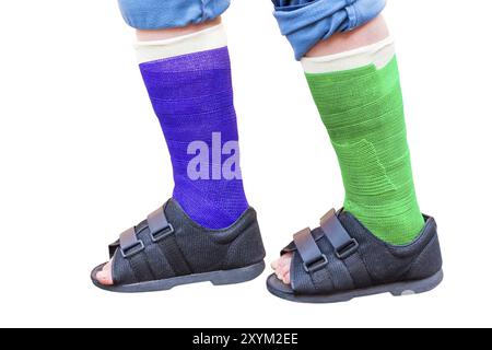 Zwei ständige farbigen Gips Beine mit Schuhen auf weißem Hintergrund Stockfoto