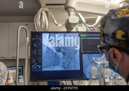 Istanbul, Türkei 29. Februar 2024; Röntgen für Klappenersatz mit Melodiebahn. Sicht auf prothetische Herzklappendysfunktion bei Patienten mit MI Stockfoto