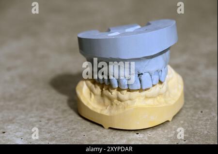 Modell eines Zahnsatzes mit Ober- und Unterkiefer Stockfoto