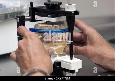 Das Prothesenmodell wird in den Artikulator eingeführt Stockfoto