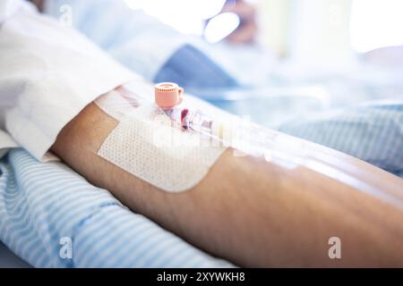 Venenkatheter am Patienten vor einer Operation Stockfoto