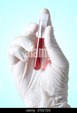 Hand hält eine Blutprobe zur Analyse Stockfoto