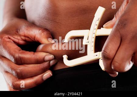 Afrikanische Frau mit einem Fettschieber zur Messung von Bauchfett, mit Schwerpunkt auf bariatrischer Gewichtsabnahme und Fettleibigkeit in der schwarzen Gemeinschaft. Stockfoto