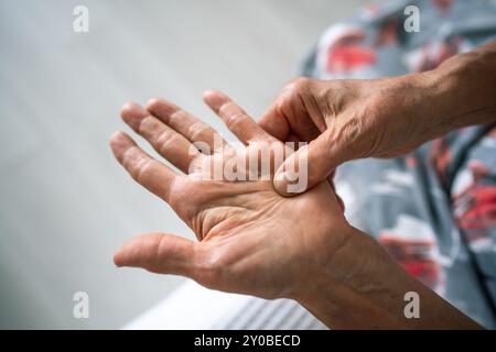 Unsichtbare alte Frau reibt sich, fühlt zarte Hand mit steifem Knoten unter dem Ringfinger. Dupuytren-Kontraktur Stockfoto