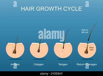 Haarwuchszyklus. Follikelanatomie. Haarwuchsphase Schritt für Schritt. Stufen von Anagen und Telogen zu Catagen. Querschnitt der Hautschichten. De Stock Vektor
