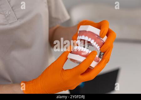 Zahnarzt, der Prothesen in der Hand hält. Zahnprothesen in Arzthänden. Zahnärztliches Foto. Prothetische Zahnheilkunde. Falsche Zähne Stockfoto