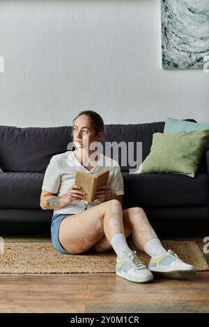 Eine Frau mit Vitiligo genießt einen ruhigen Moment beim Lesen auf dem Boden. Stockfoto