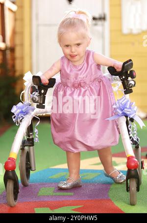 ELLIE CHALLIS MACHT IHRE ERSTEN SCHRITTE UND TRÄGT IHRE NEUEN BEINE. Ellie Challis wurde die jüngste Medaillengewinnerin der Paralympics GB bei Tokio 2020, als sie in der Women's S3 50 m Rückschlag auf das Podium erreichte. Nach den beeindruckenden ersten Jahren im internationalen Wettbewerb hält sie weiterhin einen Weltrekord und mehrere britische Besten. DER ZWILLINGSBRUDER ELLIS CHALLIS VERLOR IHRE BEINE UND ARME AN EINE MENINGITIS. SIE HAT NUN EINE NEUE PROTHESE ERHALTEN, DIE IHR DIE ERSTEN SCHRITTE ERMÖGLICHT. ROMFORD, ESSEX. BILDER:GARYROBERTS/ARLDWIDEFEATURES. KOM Stockfoto