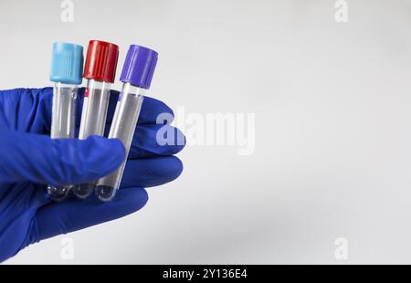 Blickwinkel der Hand eines Arztes, der eine Flasche für Proben hält Stockfoto