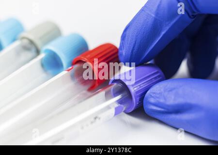 Nahaufnahme Foto von Medizin Flaschen für Proben neben Computer Tablet und Computer Tastatur im Krankenhaus oder Labor Stockfoto