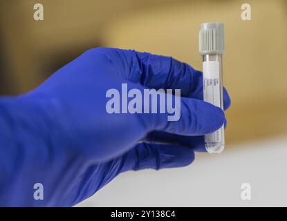 Blickwinkel der Hand eines Arztes, der eine Flasche für Proben hält Stockfoto
