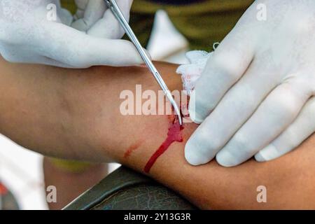 Entfernung von hormonellen Verhütungsmitteln, Lancetillo Gesundheitszentrum, La Parroquia, Quiche, Republik Guatemala, Zentralamerika. Stockfoto