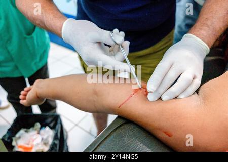 Entfernung von hormonellen Verhütungsmitteln, Lancetillo Gesundheitszentrum, La Parroquia, Quiche, Republik Guatemala, Zentralamerika. Stockfoto