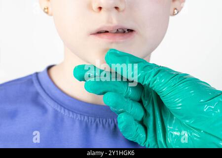 Der Arzt untersucht den Kiefer eines Mädchens, das einen falschen Biss hat. Zur Behandlung von Missverschlüssen im Kindesalter. Stockfoto