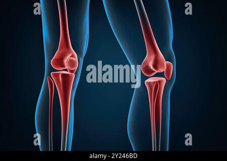 Verletzte Knie in Nahaufnahme. 3D-Abbildung. Stockfoto