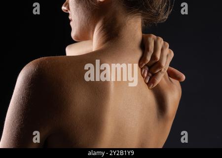 Frau massiert den Hals in Nahaufnahme, Konzept von Nackenschmerzen mit Osteochondrose-Protrusion und Hernie in der Halswirbelsäule, Stockfoto