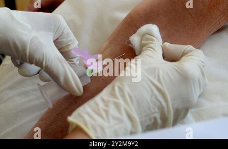 Aktenfoto vom 10/09/14 einer Krankenschwester, die sich auf die Blutentnahme im Temple Fortune Health Centre in der Nähe von Golders Green, London vorbereitet. Menschen, die ein Familienmitglied an Bauchspeicheldrüsenkrebs verloren haben, können ihr Risiko, die Krankheit zu entwickeln, mit einem neuen Online-Tool überprüfen. Der Family History Checker ist ein Novum seiner Art und hilft, Menschen mit einem vererbbaren Krankheitsrisiko zu identifizieren und sie regelmäßig zu überwachen, so dass sie die besten Chancen haben, frühzeitig diagnostiziert zu werden. Ausgabedatum: Donnerstag, 11. September 2014. Stockfoto