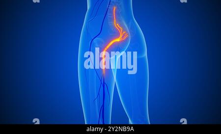 Ischiaswirbelsäule und Nervenschmerz medizinisches Konzept Stockfoto