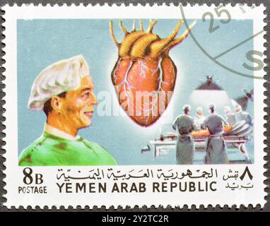 Gestempelte Briefmarke, gedruckt vom Jemen, Arabische Republik, die eine Herztransplantation von Professor Barnard zeigt, um 1968. Stockfoto