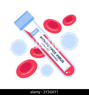Eine detaillierte Abbildung zeigt eine Affenpocken-Virus-Blutprobe neben zahlreichen roten Blutkörperchen in einem Labor-Setting Stock Vektor