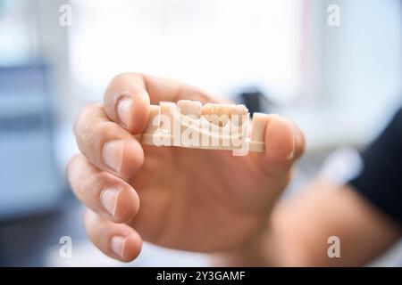 Facharzt demonstriert Modell für Zahnprothetik Stockfoto