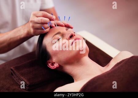 Entspannt junge Frau, die Akupunktur Behandlung im Beauty Spa Stockfoto