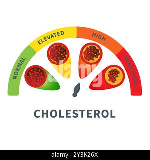 Cholesterinspiegelmessgerät mit Blutgefässdiagramm Stock Vektor