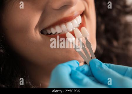 Doktor überprüft die Zahnfarbe der jungen Frau, Nahaufnahme. Zahnfurniere Stockfoto