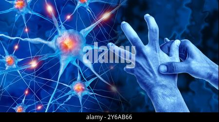 Morbus Parkinson als progressive neurologische Störung, die die Körperbewegung und Koordination beeinflusst, da Nervenzellen ihre Funktion in der Substantia verlieren Stockfoto