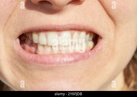 Nahaufnahme des Mundes einer Frau mit gesunden weißen Zähnen und natürlichen Lippen in hellem Licht Stockfoto