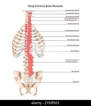 Die tiefe intrinsische Rückenmuskulatur, transversospinalis. Rückgrat-Muskelsystem. Markierte anatomische Struktur der Wirbelsäulenmuskulatur vom Kreuzbein zur Achse. Illustration des flachen Vektors Stock Vektor