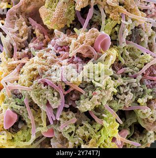 Plakette - Bakterien, Farbig Scanning Electron Micrograph (SEM). Plaque besteht aus einem Film von Bakterien in einem glykoprotein Matrix eingebettet. Die Matrix ist eine bakterielle Sekrete und Speichel gebildet. Zahnbelag ist die Hauptursache für Karies. Die Bakterien ernähren sich von Zucker in der Nahrung, die Säure als Abfallprodukt. Diese Säure greift die Zähne emailbeschichtung, was zu Karies. Die Ansammlung von Zahnbelag kann auch entzündete und infizierten Zahnfleisch führen. Schwere Zahnfleischerkrankungen können Zähne herausfallen führen. Vergrößerung: x2000 bei 10 Zentimeter gedruckt Stockfoto