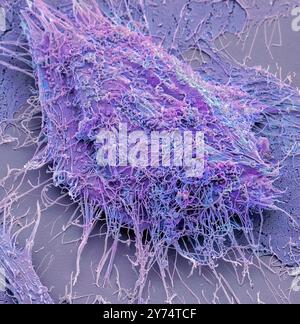 Mesenchymale Stammzellen. Farbige Scanning Electron Micrograph (SEM) eines menschlichen mesenchymalen Stammzellen (MSC). MSCs sind multipotent Stromatumoren (Bindegewebe) Zellen, unterscheiden können in eine Vielzahl von Zelltypen, einschließlich der Osteoblasten (knochenbildende Zellen), Chondrozyten (Knorpelzellen) und adipozyten (fettzellen). Der jüngste, Primitivsten MSCs können aus der Nabelschnur Gewebe bezogen werden. Vergrößerung: x3000, wenn 10 Zentimeter Breite gedruckt. Stockfoto