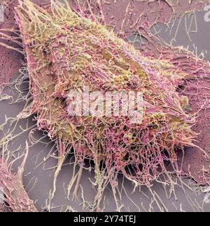 Mesenchymale Stammzellen. Farbige Scanning Electron Micrograph (SEM) eines menschlichen mesenchymalen Stammzellen (MSC). MSCs sind multipotent Stromatumoren (Bindegewebe) Zellen, unterscheiden können in eine Vielzahl von Zelltypen, einschließlich der Osteoblasten (knochenbildende Zellen), Chondrozyten (Knorpelzellen) und adipozyten (fettzellen). Der jüngste, Primitivsten MSCs können aus der Nabelschnur Gewebe bezogen werden. Vergrößerung: x3000, wenn 10 Zentimeter Breite gedruckt. Stockfoto