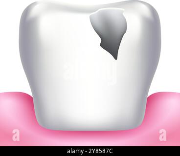 Gebrochener Zahn mit Loch im Schmelz. Darstellung der zahnärztlichen Behandlung Stock Vektor