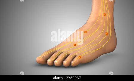 Taubheitsgefühl und Kribbeln im Fuß Stockfoto