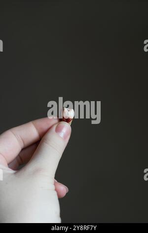 Der häufigste Grund ist das Zähneputzen und das Essen von Süßigkeiten Stockfoto