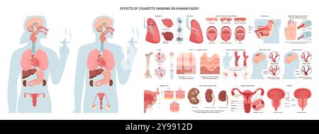 Auswirkungen des Zigarettenrauchens auf den menschlichen Körper. Gesundheitliche Probleme und Risiken von Rauchern. Erkrankungen der menschlichen inneren Organe durch Nikotin. Illustration des flachen Vektors Stock Vektor