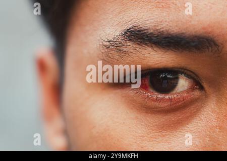 Nahaufnahme eines irritierten oder blutunterlaufenen Auges mit roter Farbe eines Mannes mit Bokeh-Hintergrund Stockfoto