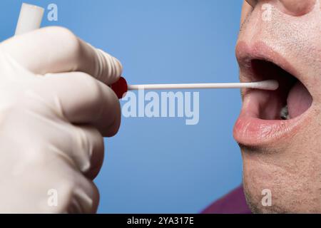 Der Mann benutzt ein DNA-Reagenzglas und einen Wattestäbchen, Wischtest Stockfoto