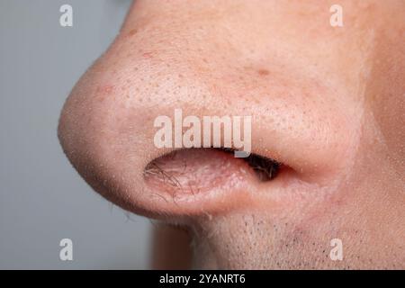 Kaukasischer Mann, offene Nase, blickt hoch, Makroaufnahme aus der Nähe, nicht erkennbar. Stockfoto