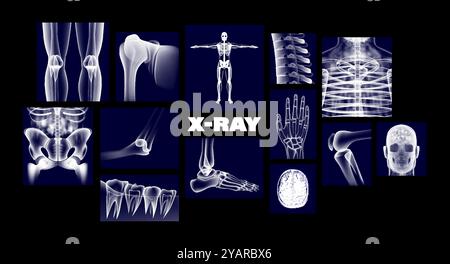 Medizinische Röntgenbilder des menschlichen Körpers Stock Vektor