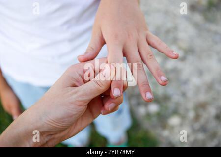 Das Kind zeigt seine Hände mit Schmutz unter den Nägeln. Stockfoto