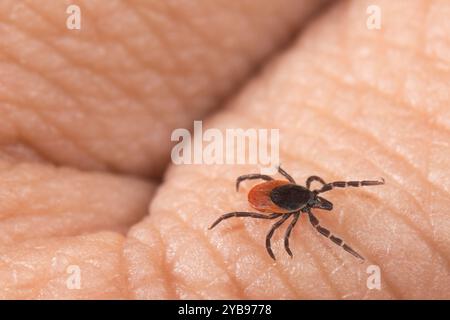 Weibliche Hirschzeckenparasitin krabbelt auf einem menschlichen Finger-Hauthintergrund. Gefahr der Übertragung von Zeckenerkrankungen als Enzephalitis und Lyme-Borreliose. Stockfoto