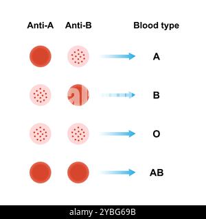 ABO-Blutgruppen, Abbildung. Stockfoto