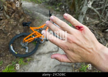 Armverletzung beim Mountainbiken auf Florida Dschungelwegen. Rote blutige Wunde, weil sie einen Baumstumpf getroffen hat. Radunfall. Stockfoto