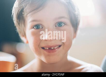 Junge mit einer Zahnlücke Stockfoto